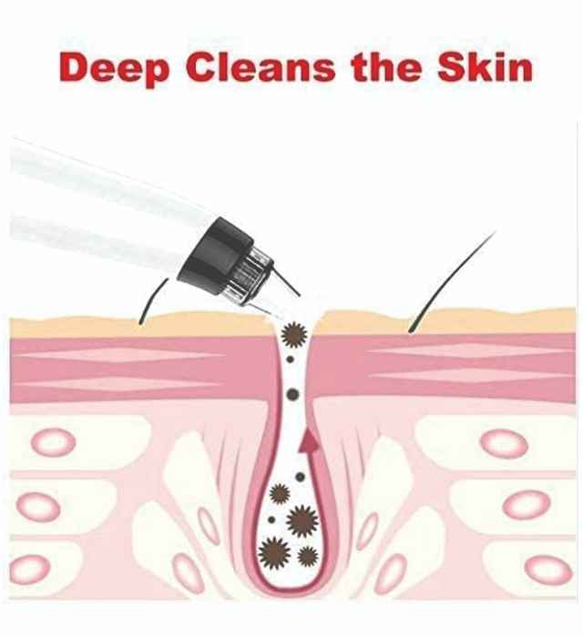 DERMA-SUCTION-4.jpg